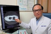 久咳不癒竟藏危機 LDCT助主婦揪出早期肺癌
